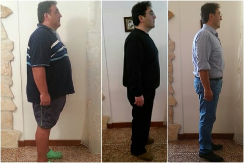 Trasformazione PRIMA e DOPO di un paziente del Metodo SENZADIETA