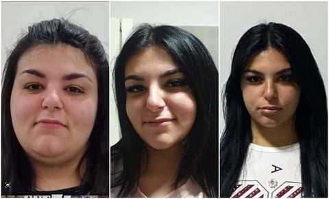 Trasformazione PRIMA e DOPO di un paziente del Metodo SENZADIETA