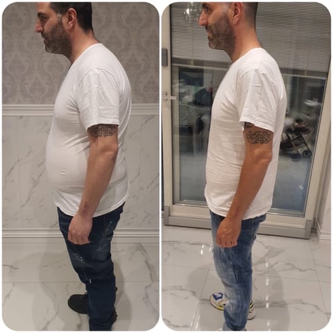 Trasformazione PRIMA e DOPO di un paziente del Metodo SENZADIETA